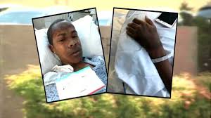 Teen 'permanently disfigured' during classroom chemistry experiment gone  wrong, attorney says