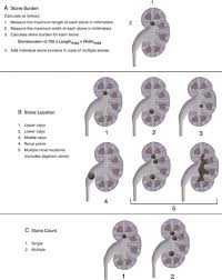Image result for STONE Score