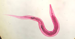 Får du mark i magen, så har du mest sannsynlig fått den i deg innendørs. Behandling Mot Barnemark Bytt Sengetoy Med En Gang