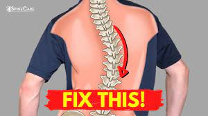 Find out what we tell them and how it applies to you. How To Relieve Your Scoliosis Back Pain In 30 Seconds Youtube