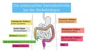 Darmspiegelung Koloskopie Wie Ist Der Ablauf Was Darf Ich Essen Wie Hoch Sind Die Kosten Cara Care
