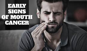 Symptoms of oral cancer can include: Early Signs Of Mouth Cancer Baccoff