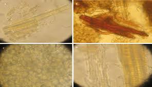 Image result for Anemia angolensis