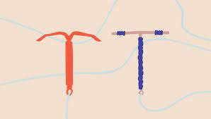 What Is An Iud The Ins And Outs Of The Intrauterine Device