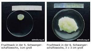 Abtreibung At