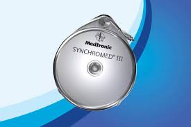 Image result for Intrathecal Pump