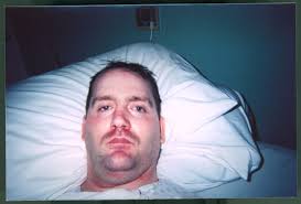 Warehousing the Disabled: the case of Ron Wilkison by Kristin Giganti