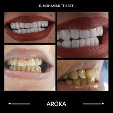 عيادة اروكا 0545359682 اختيارك عند البحث عن عياده اسنان بالرياض عيادة جلديه بالرياض جلسات ليزر بالرياض جلسات بوتوكس بالرياض جلسات فيلر بالرياض تقويم أسنان بالري convenience store products convenience store