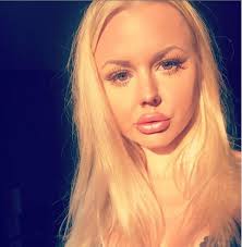 He love to create and be creative. Shocking Stockholm Mother S Breast Implant Falls Out After Two Weeks Of Surgery