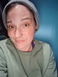 Has anyone explored the idea that they may be mistaking NPD with Aspergers  Syndrome? In my research I have discovered Aspergers is often misdiagnosed  NPD and I recall before my diagnosise it