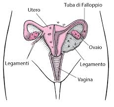 L'endometriosi è una patologia che prevede la presenza di tessuto endometriale in sedi differenti da quella fisiologica cioè l'interno della cavità uterina. Endometriosi Problemi Di Salute Delle Donne Manuale Msd Versione Per I Pazienti