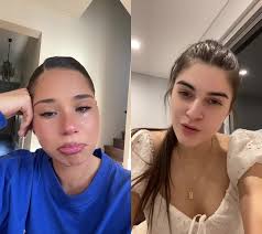 Embracing Skin Insecurities: Abby Elizabeth's Inspiring Video Reaction