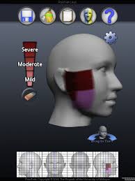High-Definition and Non-invasive Brain Modulation of Pain and&nbsp;Motor  Dysfunction in Chronic TMD