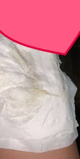 But as ovulation approaches, the do you think i might be pregnant? Is This Discharge Normal Sexual Health Forums Patient