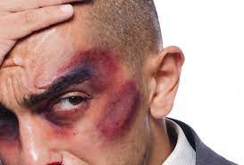 Noticias Bogota Vecinos De Soacha Golpean A Hombre Por Un Chisme Alerta Bogota