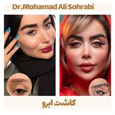 Eyebrow transplantation