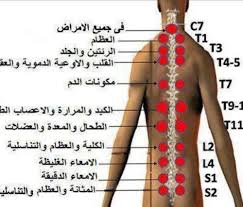 الحجامة ونقاط الطاقة الرئيسية الطب العربي البديل