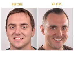 OrtoLife-Centrul Ortodontic Cluj