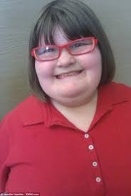 Anna Hankins who suffers from Prader-Willi Syndrome wins beauty pageant