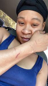 My 3 month old Ascent already has so many scratches 😩