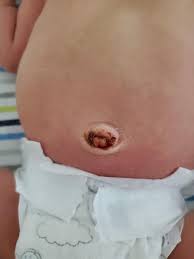 Newborn really do not get all that dirty. My Sons Umbilical Cord Got Stuck To Clothes And Fell Off Should I Call His Pediatrician He Is 8 Days Old Newborns