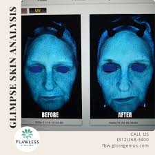 Flawless by Wellness