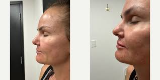 Stuart Diamond, MD, Board Certified Urologist