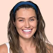 Monique Riley Schroeder's Smile Makeover