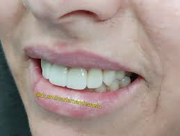 Consultório Odontológico Dr. Maikel André Gerhard updated their profile  picture.