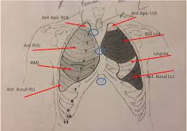 Lung Auscultation Physical Therapy Reviewer