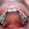 At least one out of four teenagers and young adults who get infected with ebv will develop. Https Encrypted Tbn0 Gstatic Com Images Q Tbn And9gcrgis2rbsimgxogphwcszvuzrlqwyvxwr Zmvye6wfz54jh40rn Usqp Cau