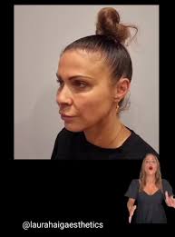 Laura Haig Aesthetics (@laurahaigaesthetics)