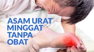 277 likes 17 talking about this. Cari Tahu Obat Asam Urat Alami Di Sini Alodokter