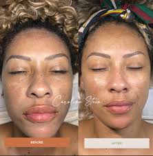 Caroline Stein Beauty In Del Mar CA