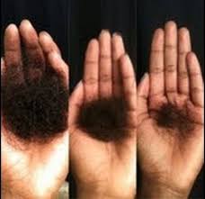 The brushing or combing part should be noted, because not. Black Tea Rinses Can Stop Shedding Dead In Its Tracks Natural Hair Styles Hair Shedding Hair Treatment