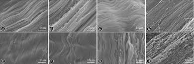 They are actually heavily composed of connective. Optical Microscopy And Electron Microscopy For The Morphological Evaluation Of Tendons A Mini Review Xu 2020 Orthopaedic Surgery Wiley Online Library