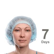 Scialoendoscopia, la nuova frontiera per la cura dei calcoli salivari. Con  un intervento rapido si salva la ghiandola salivare. Presso la nostra  clinica l'intervento viene eseguito dal Professor Pasquale Capaccio,  specialista in