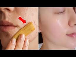 This Is Not A Joke Rub A Banana Peel On Your Face Home Remedies Tv Banana Peel Uses Natural Facial Fight Wrinkles