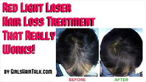 These photons are absorbed by weak cells to encourage hair growth. Laser Treatment For Hair Loss Tips For Faster Regrowth