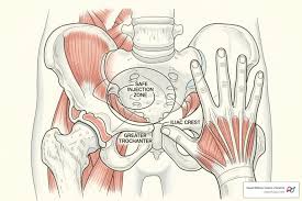 Image result for Intramuscular Injection
