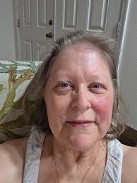 Pls having scratch under my right eye 👀 all the time any meaning or sign