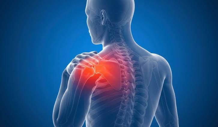 What Causes Frozen Shoulder? | MHV Clinic