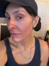 Excellent share. Hugs. Get well soon