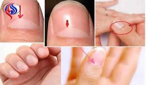 عهد رونالدو يخيف يوفنتوس في دوري الأبطال. ÙØ§ Ø³Ø± ÙØ¬ÙØ¯ ÙØ°Ø§ Ø§ÙÙÙØ§Ù Ø§ÙØ£Ø¨ÙØ¶ Ø¹ÙÙ Ø§ÙØ£Ø¸Ø§ÙØ± ÙÙØ§Ø© Ø§ÙØ¹Ø§ÙÙ Ø§ÙØ§Ø®Ø¨Ø§Ø±ÙØ©