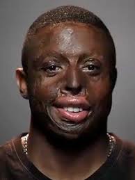 Impact: After the Crash Shares Lessons from Worst Drunk Driving Crash in  History