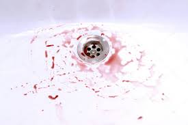 We did not find results for: Blood Stains In The Bathroom Sink Bleeding Criminal And Suicide Concept 223518050 Larastock