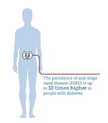 How does diabetes cause kidney disease? Kidney And Diabetes