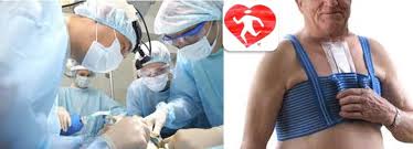 Adresa url solicitată nu a fost găsită pe acest server. Recuperarea CardiovascularÄƒ DupÄƒ OperaÈ›ia Pe Cord Clinica De Cardiologie Cardioclass