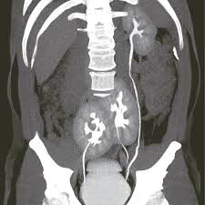 Pin On Abdomen Pelvis