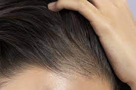 You can do this right after you wash your hair, but if you need to tame your baby hairs between washes, just use a spray bottle or your fingers to dampen the hair all along your hairline. Baby Hair Or Breakage What S The Difference Prose Hair
